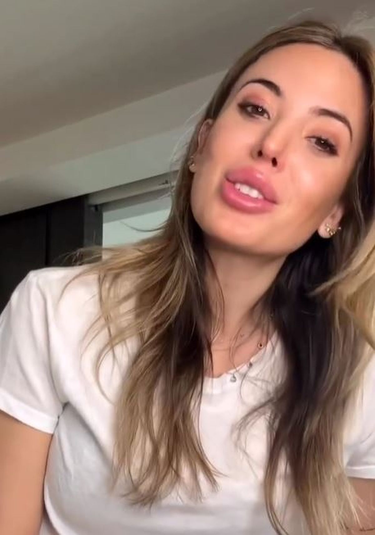 El tamaño de los labios de Jesica Cirio llamó la atención de los usuarios. El tamaño de los labios de Jesica Cirio llamó la atención de los usuarios.