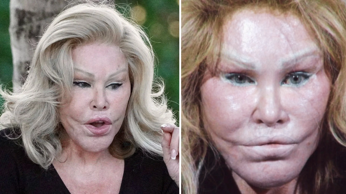 La adicta a la cirugía Jocelyn Wildenstein. La adicta a la cirugía Jocelyn Wildenstein.