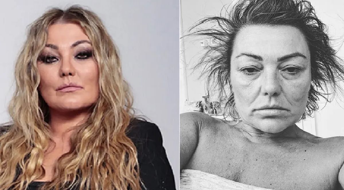 Fuerte imagen de la excantante de La Oreja de Van Gogh genera preocupación