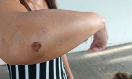 La mujer intentó resistirse al asalto y los ladrones la tumbaron al piso La mujer intentó resistirse al asalto y los ladrones la tumbaron al piso