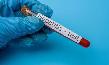recomiendan realizarse el test de hepatitis, enfermedad que afecta a 300.000 personas en el pais recomiendan realizarse el test de hepatitis, enfermedad que afecta a 300.000 personas en el pais