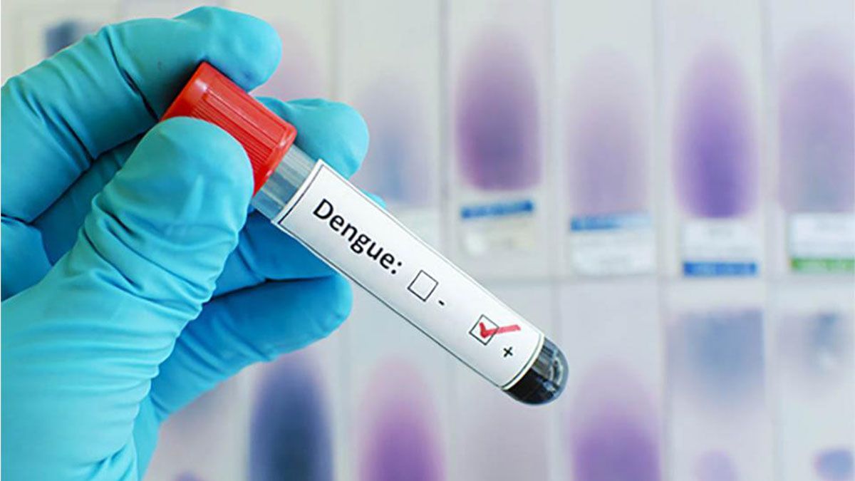 Actualmente, en Argentina circulan dos serotipos de dengue, DENV-1 y DENV-4.