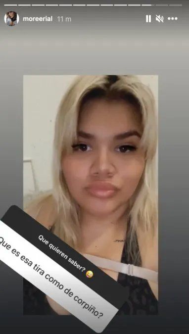 More Rial habló de su cirugía de busto y dio detalles.