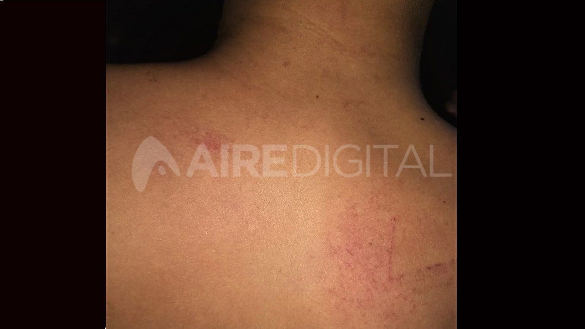 Me apoy&oacute; un arma en la cabeza y me pega un tiro. Ah&iacute; me sac&oacute; por la ventana que da a un patio