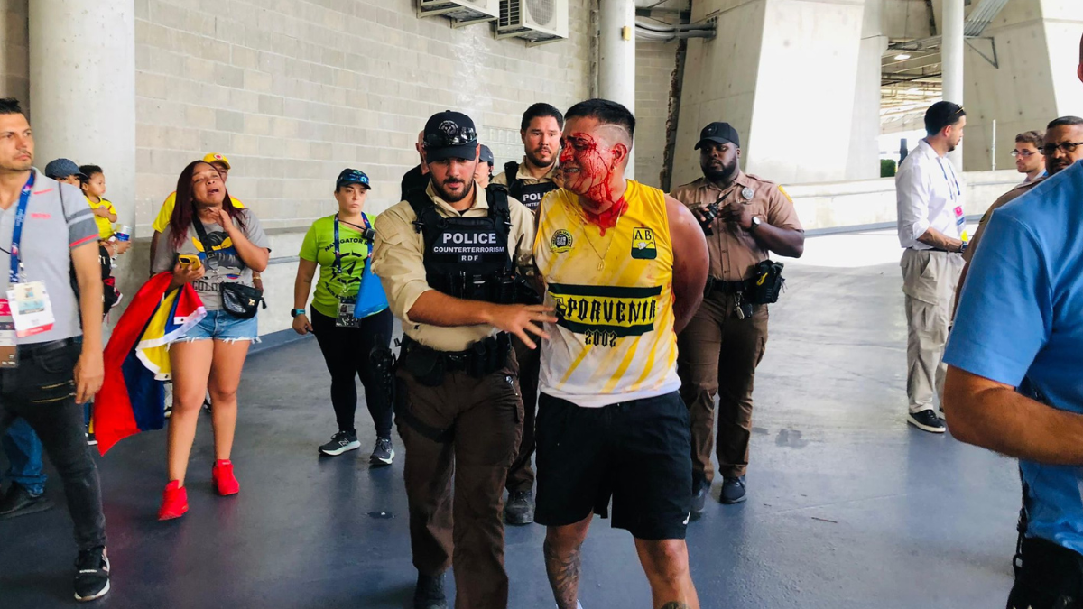 Un espectador colombiano se retiró esposado y con la cara ensangrentada del Hard Rock Stadium. Un espectador colombiano se retiró esposado y con la cara ensangrentada del Hard Rock Stadium.