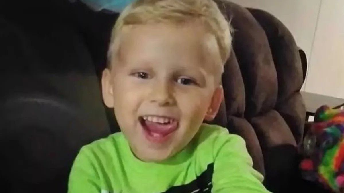 Ataque salvaje: el pitbull de la familia le arrancó el brazo a un niño de 4 años