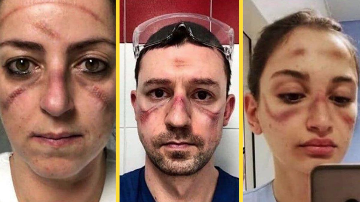 FOTOS: Las impactantes imágenes de médicos que luchan contra coronavirus en Italia